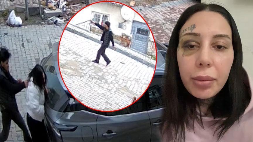 Eşinin Başına Silah Dayayan Saldırgan Tutuklandı: "Estetik Yaptırıp Boşanmak İstedi" Savunması