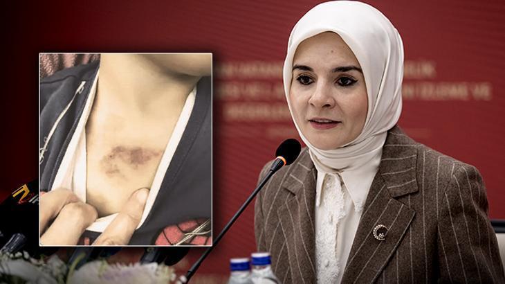 Aile Bakanı Göktaş'tan Üzen Açıklamalar: Kreşte Darp ve İstismar İddiaları ve Denetimsizlik Eleştirisi