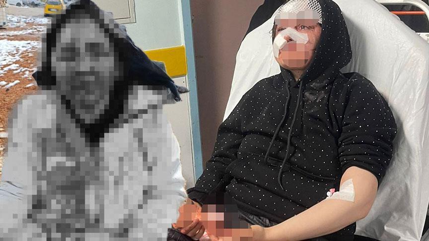Boşanma Talebi Dehşetle Karşılandı: Eşini Taşla Komalık Etti