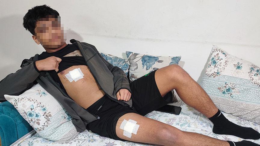 Gençler Arasında Tartışma Kanlı Bitti: 15 Yaşındaki Çocuk Bıçaklandı