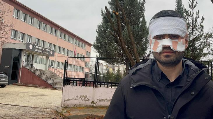 Okulda Şok Eden Saldırı: Rehber Öğretmen, Fizik Öğretmenini Kaynar Çayla Haşladı
